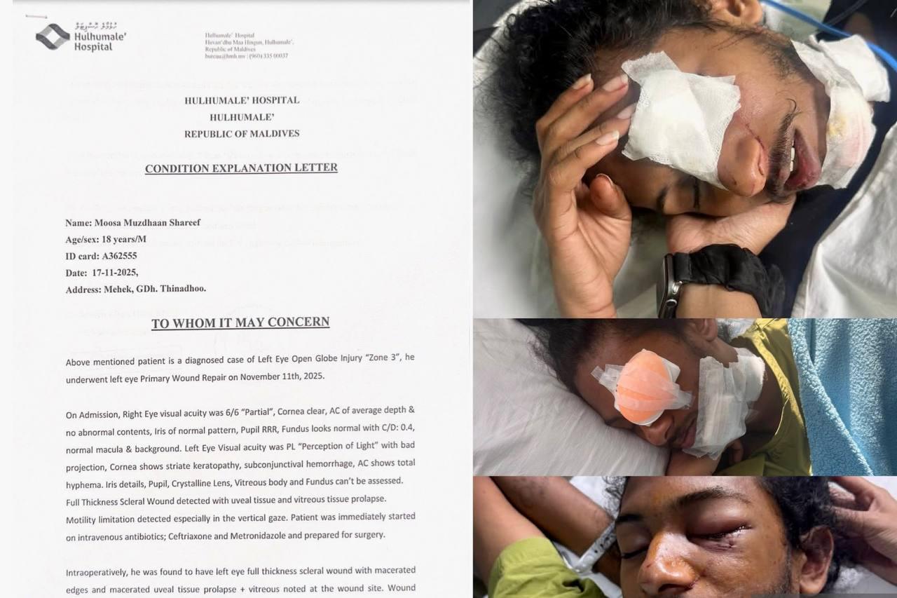 މުޒްދާންގެ ލޮލުގެ ފެނުން އަނބުރާ ހޯދުމަށް އެދެނީ ދީލަތީ އެހީތެރިކަމަށް 